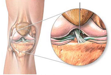 Ligament croisé