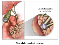 Voies biliaires - LVBP