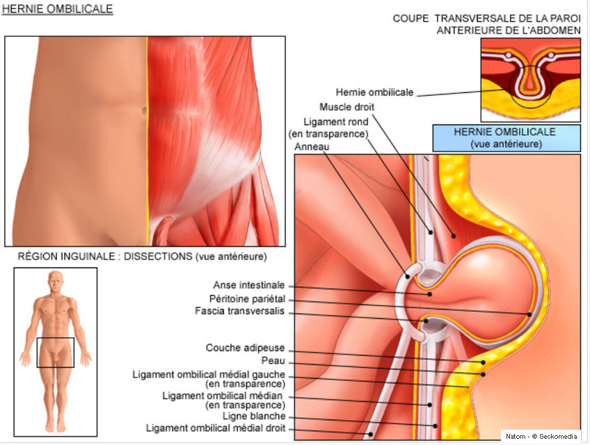 CHIRURGIE GÉNÉRALE - Hamilcar Medical