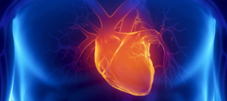 Cardiologie interventionnel